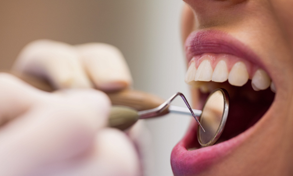 Entreprise à vendre -blanchiment des dents 1